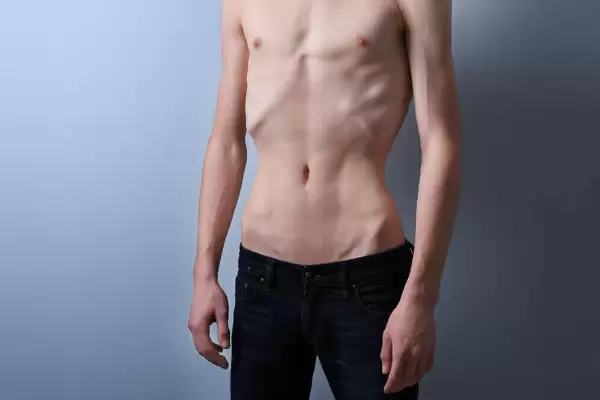 إن كنت نحيفا وتحاول مراراً أن تزيد من وزنك فأنت لست وحدك، يواجه العديد من الناس نفس المشكلة ولكن الخبر الجيد أنه لكل مشكلة حل والخطوة الأولى في حل المشكلة هو تحديد العوائق، تعرف عليها. 
